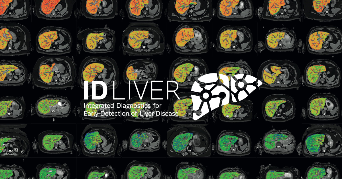Perspectum partners in a multimillion pound research project (ID-LIVER ...