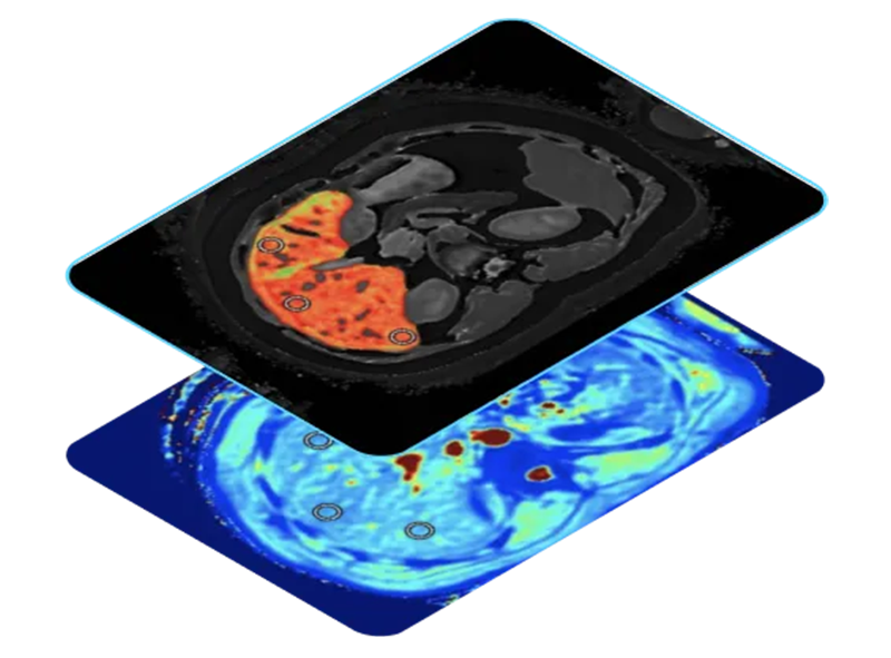 LiverMultiScan