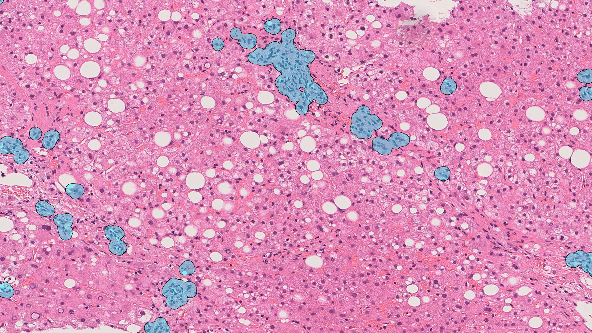 H&E slide with PAIR MASH inflamed region identification